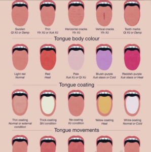 Tongue diagnosis