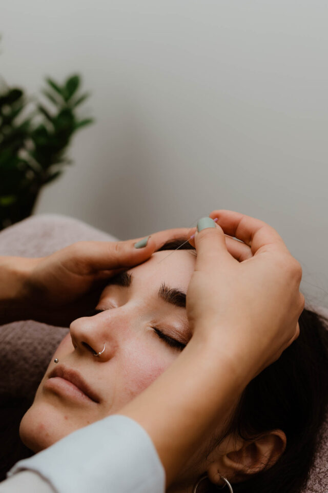 Acupuncture for Headaches