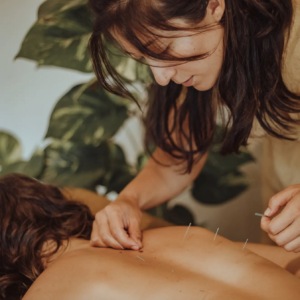An acupuncture treatment on the back for back pain relief 
