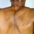 Glowing skin due to good gut health