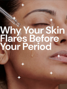 why your skin flares before your period